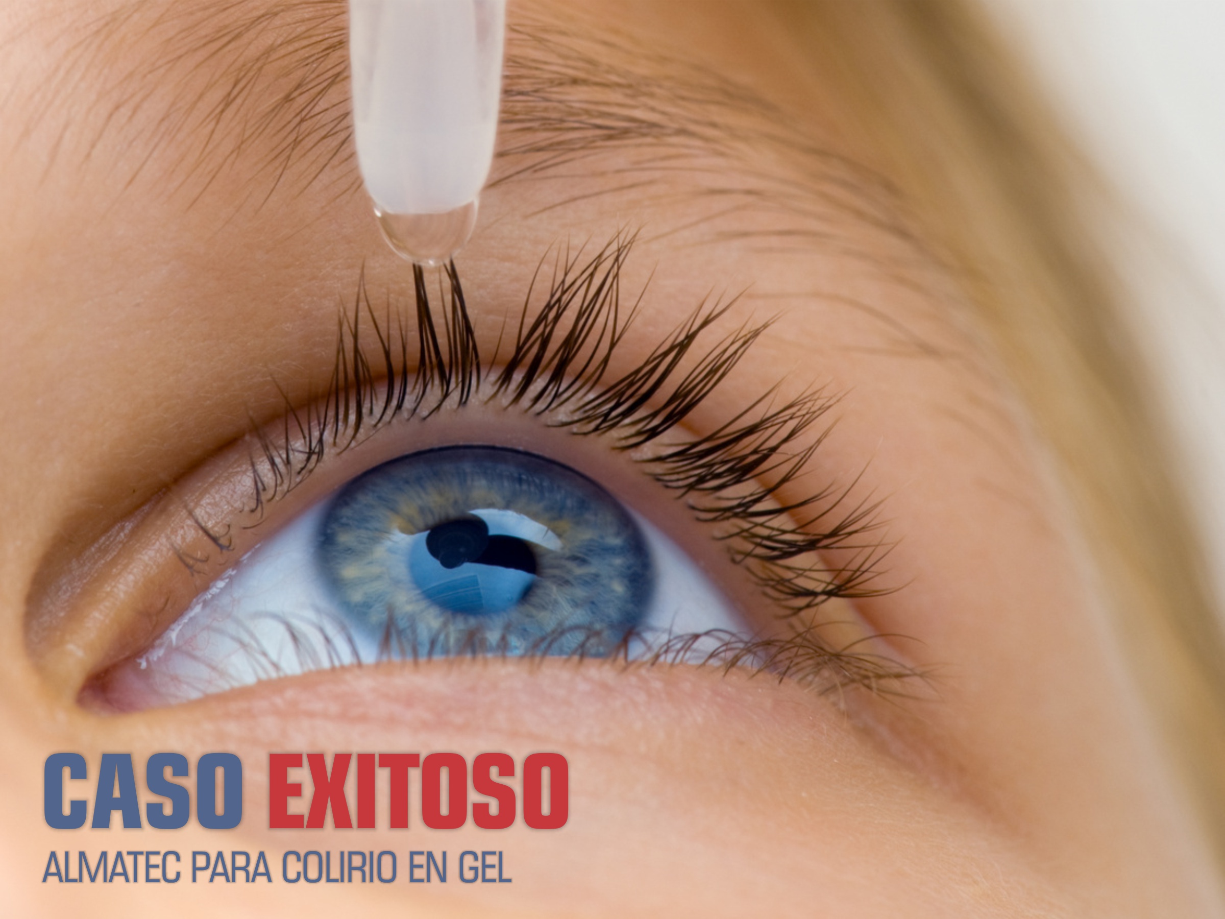 CASOS EXITOSOS – ALMATEC PARA COLIRIO EN GEL 